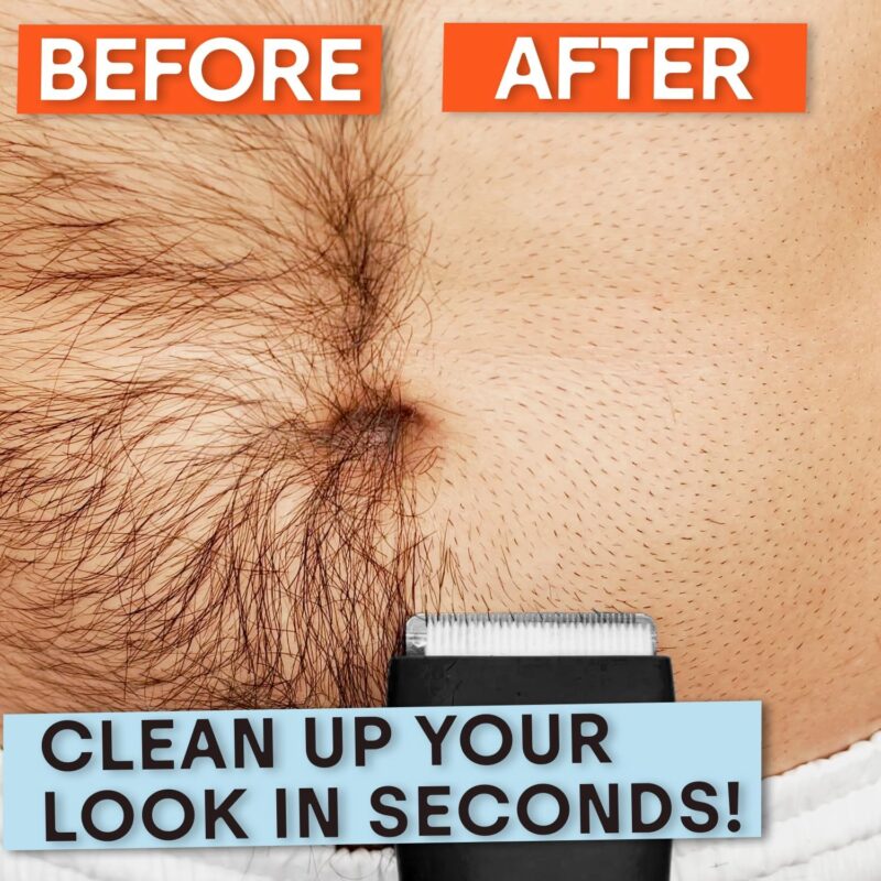 Meridian The Trimmer Premium (Body Hair Trimmer)